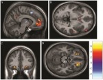 El amor es mejor que las drogas para reducir el dolor, afirman neurocientíficos